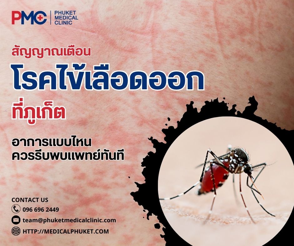 สัญญาณเตือนโรคไข้เลือดออกที่ภูเก็ต อาการแบบไหนควรรีบพบแพทย์ทันที