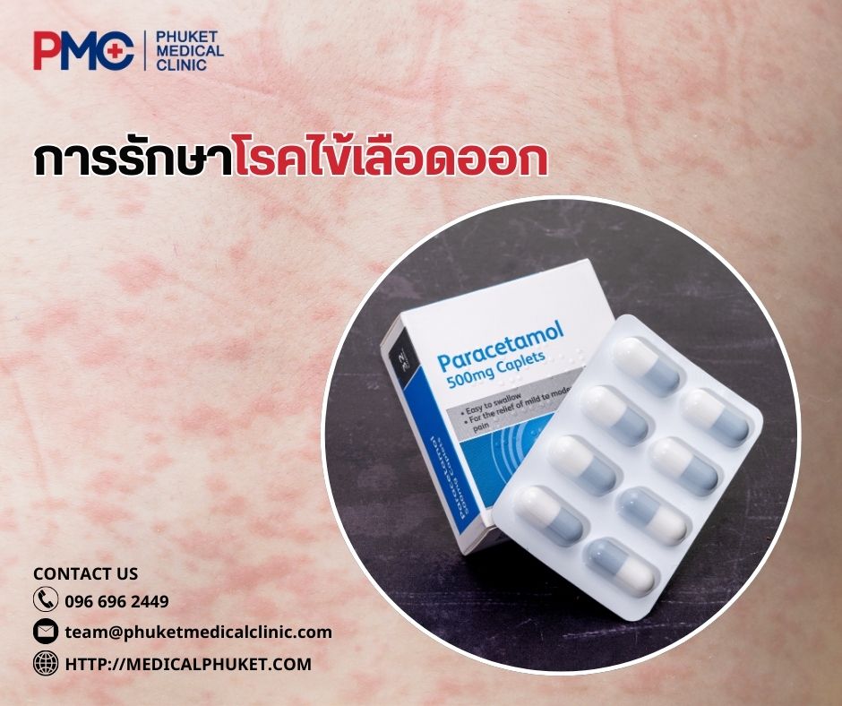 การรักษาโรคไข้เลือดออก