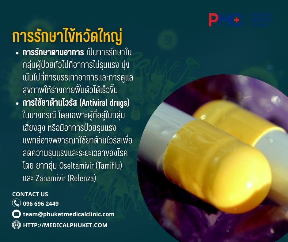 การรักษาไข้หวัดใหญ่