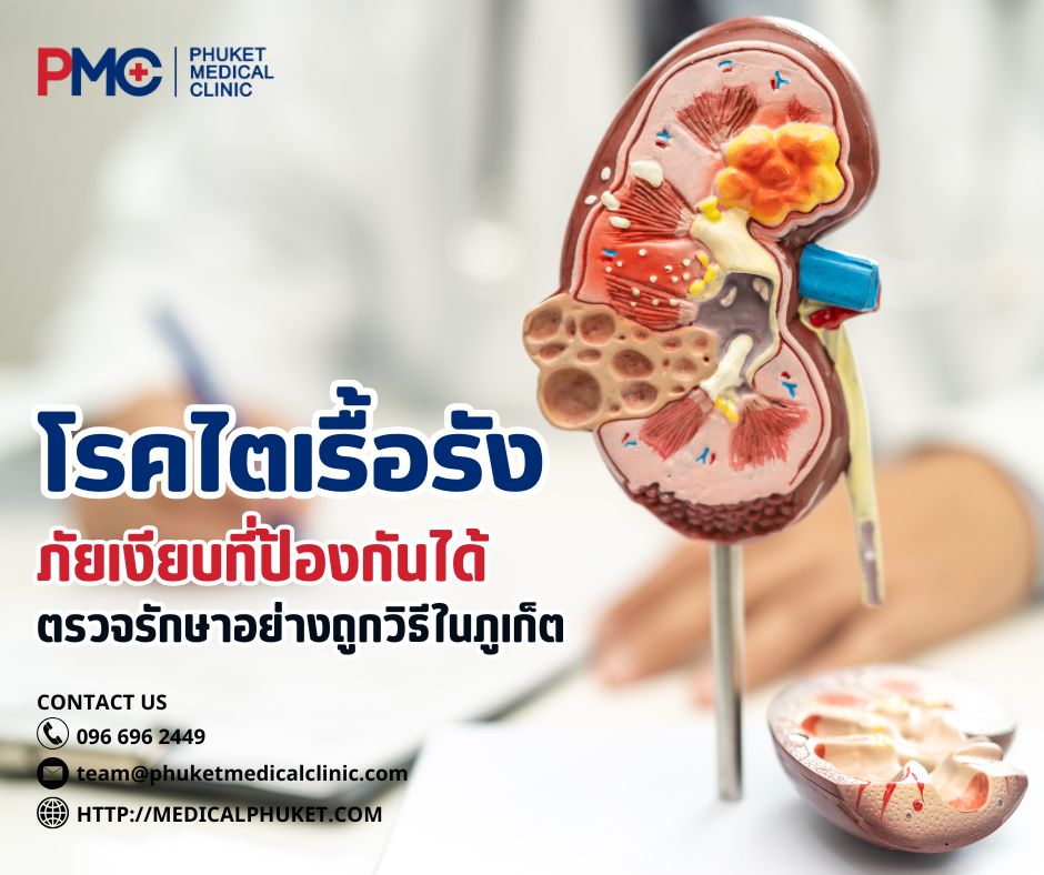โรคไตเรื้อรัง ภัยเงียบที่ป้องกันได้ หากตรวจรักษาอย่างถูกวิธีในภูเก็ต