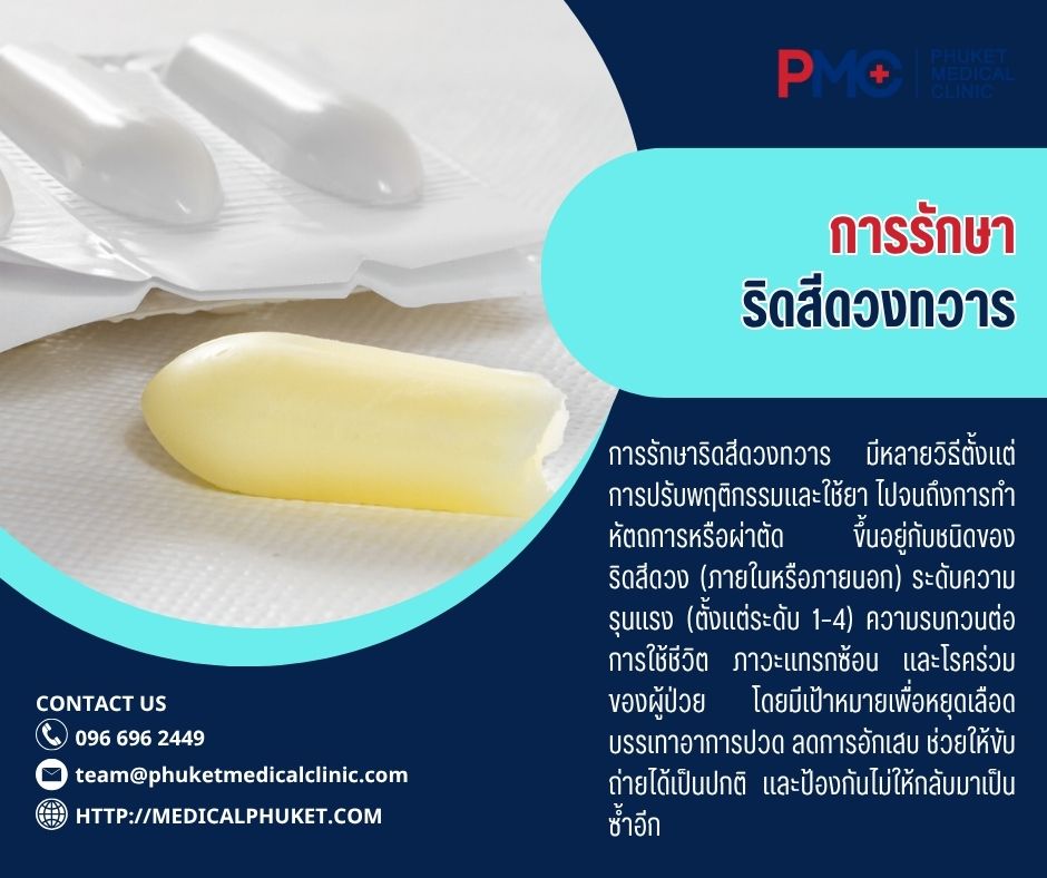 การรักษาริดสีดวงทวาร