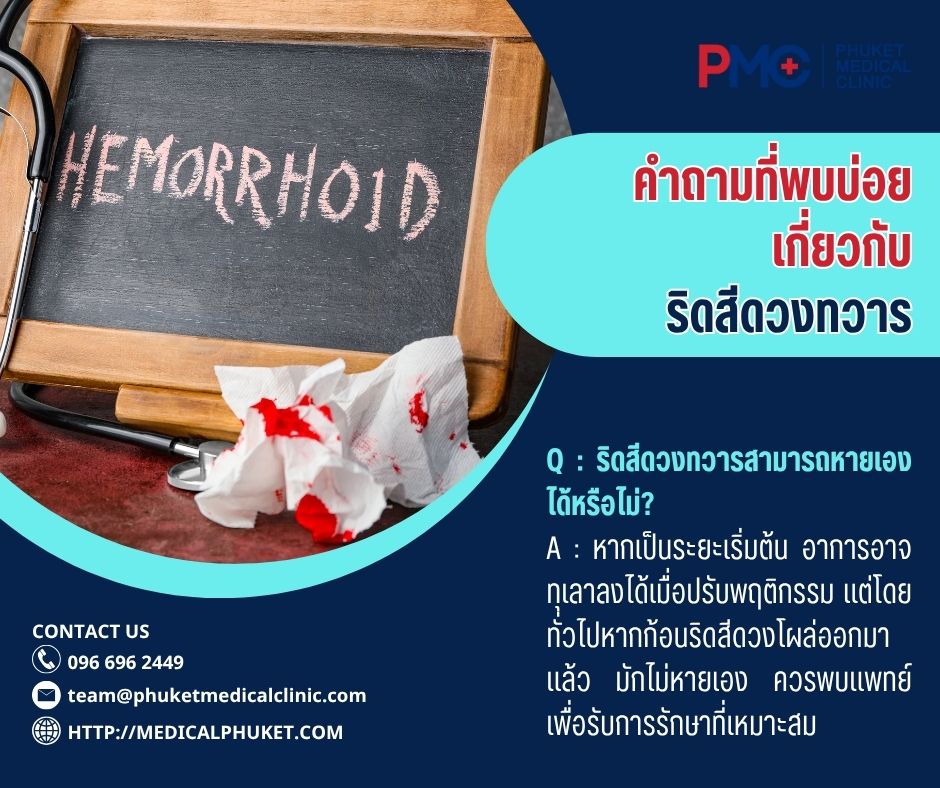 คำถามที่พบบ่อยเกี่ยวกับริดสีดวงทวาร