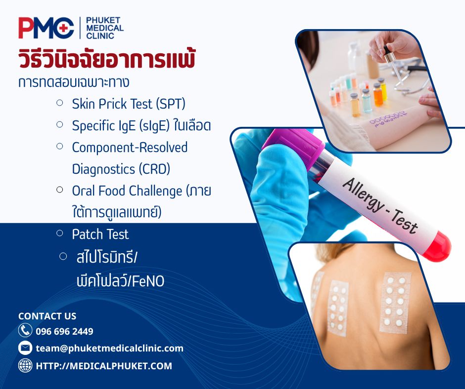 วิธีวินิจฉัยอาการแพ้