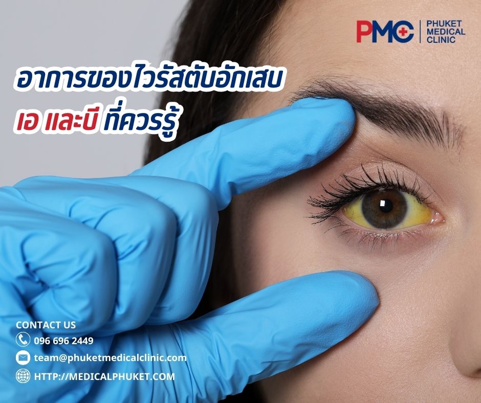 อาการของไวรัสตับอักเสบเอ และบี ที่ควรรู้
