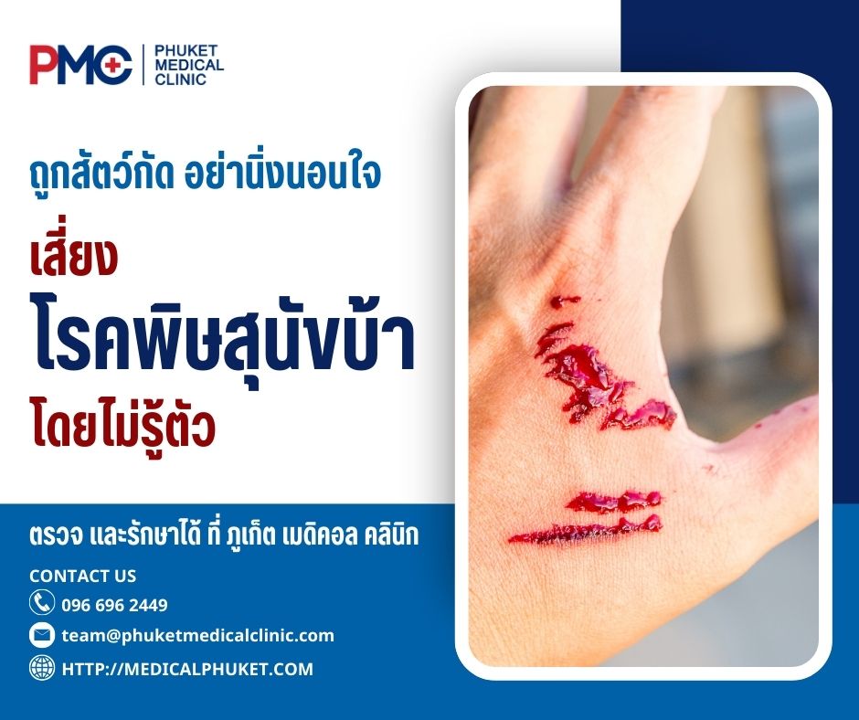 ถูกสัตว์กัด อย่านิ่งนอนใจ เสี่ยงโรคพิษสุนัขบ้าโดยไม่รู้ตัว ตรวจและรักษาได้ที่ ภูเก็ต เมดิคอล คลินิก