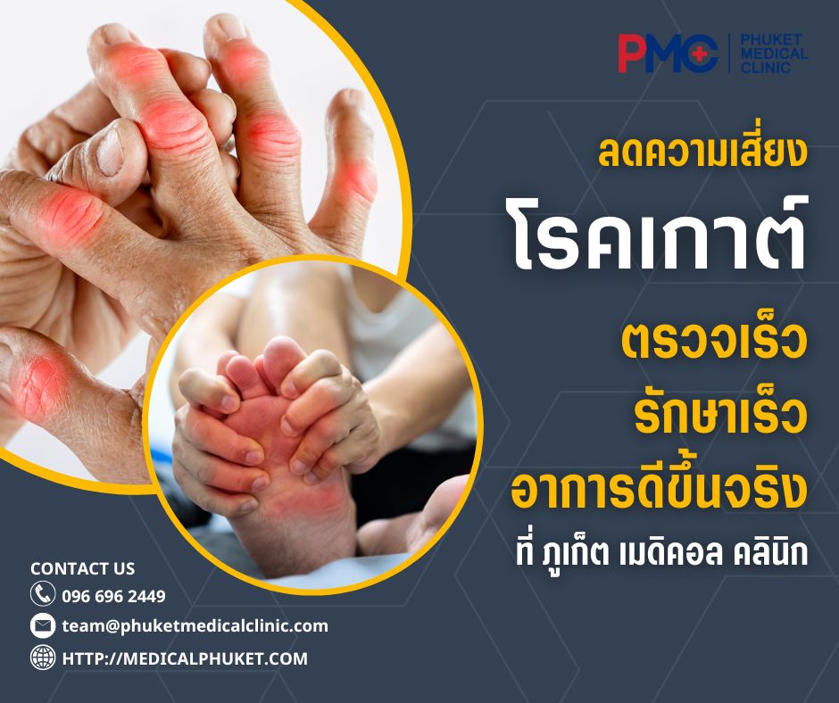 ลดความเสี่ยงโรคเกาต์ ตรวจเร็ว รักษาเร็ว อาการดีขึ้นจริง ที่ภูเก็ต เมดิคอล คลินิก