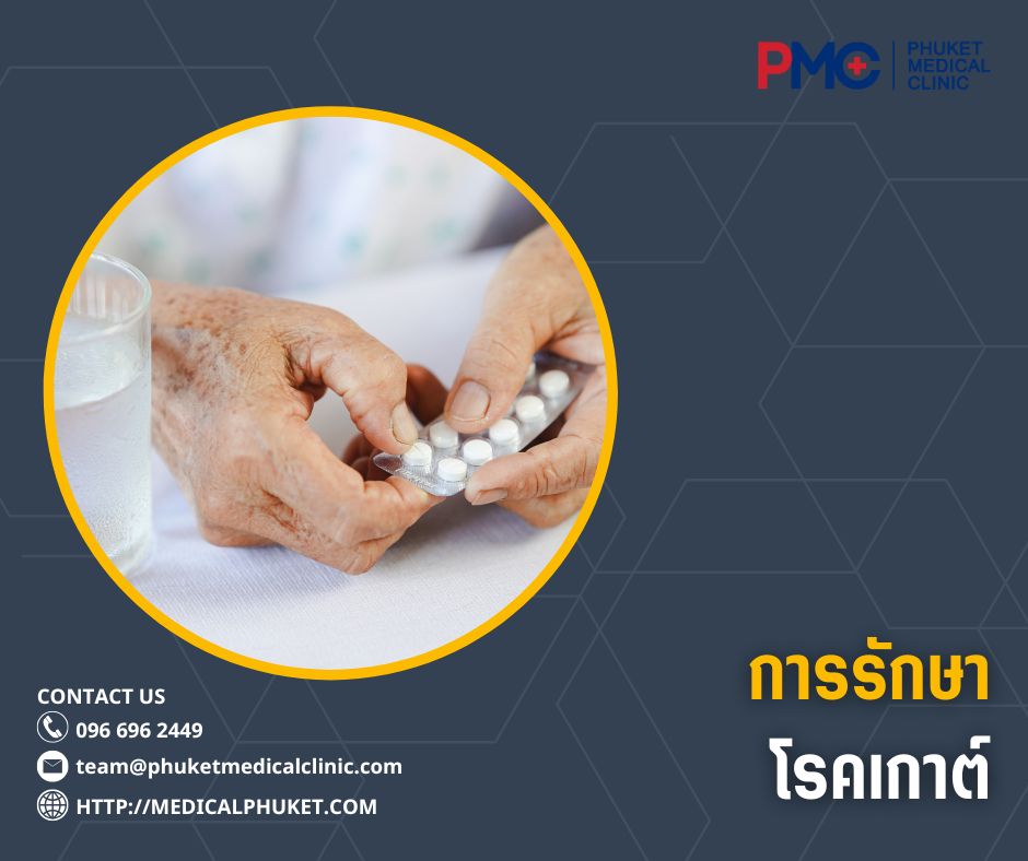 การรักษาโรคเกาต์