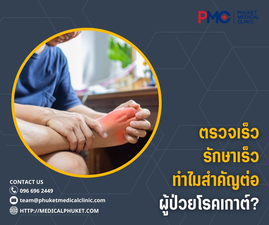 ตรวจเร็ว รักษาเร็ว ทำไมสำคัญต่อผู้ป่วยโรคเกาต์