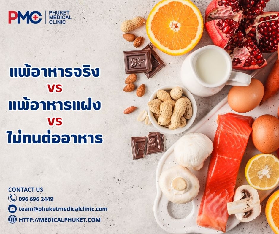 แพ้อาหารจริง vs แพ้อาหารแฝง vs ไม่ทนต่ออาหาร