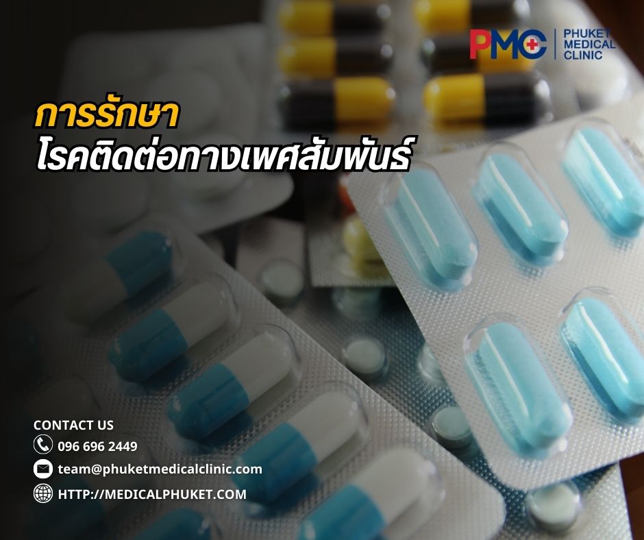 การรักษาโรคติดต่อทางเพศสัมพันธ์