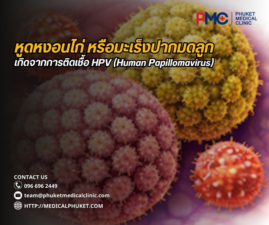 หูดหงอนไก่(Genital Warts ) หรือมะเร็งปากมดลูก(Cervical Cancer) _ ภัยเงียบจากการติดเชื้อ HPV