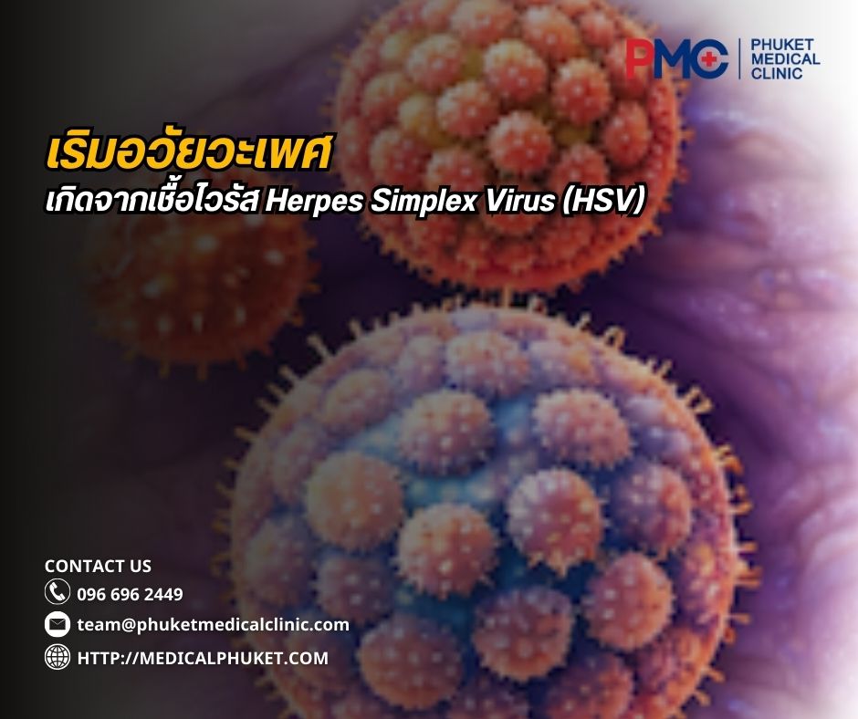 เริมอวัยวะเพศ เป็นโรคติดต่อทางเพศสัมพันธ์ที่เกิดจากเชื้อไวรัส Herpes Simplex Virus (HSV)