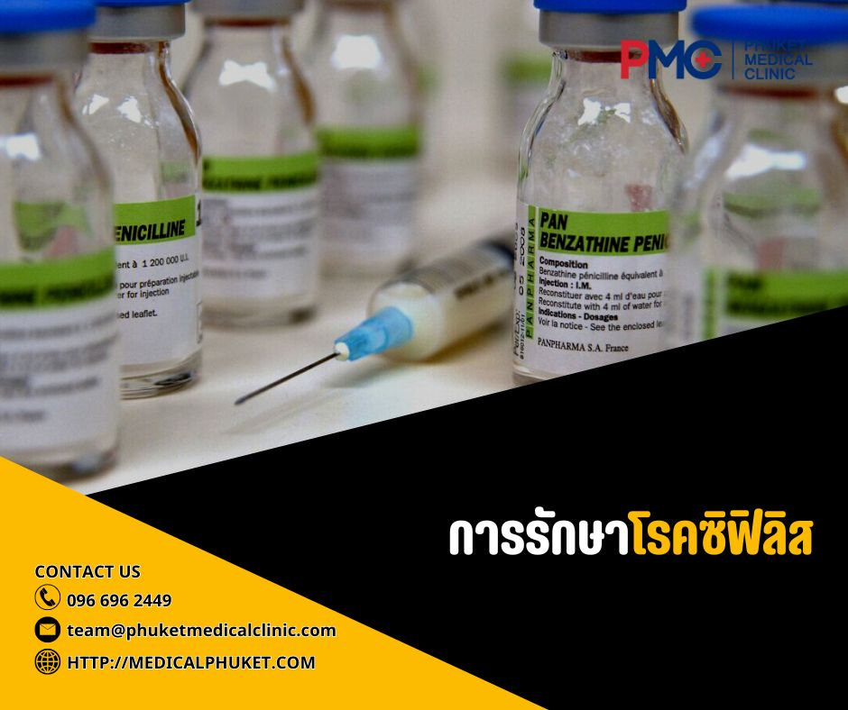 การรักษาโรคซิฟิลิส