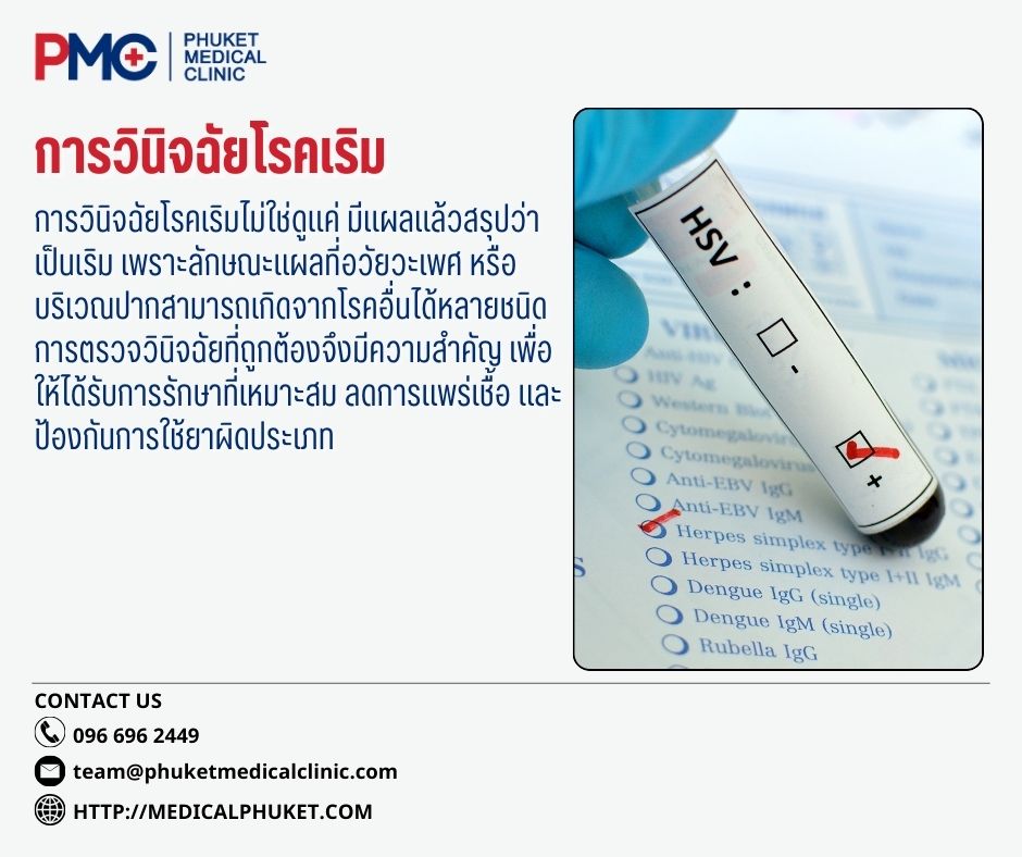 การวินิจฉัยโรคเริม