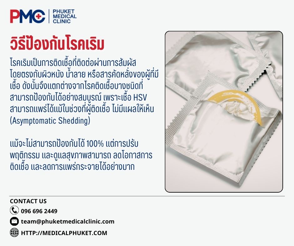 วิธีป้องกันโรคเริม