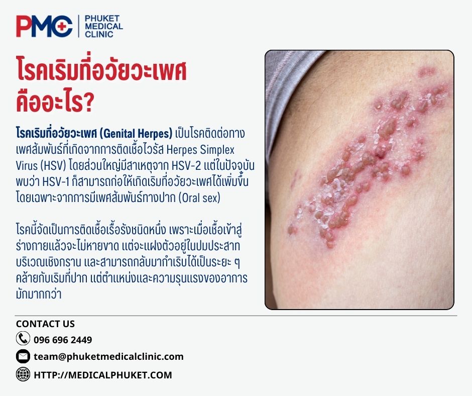 โรคเริมที่ปาก คืออะไร (2)