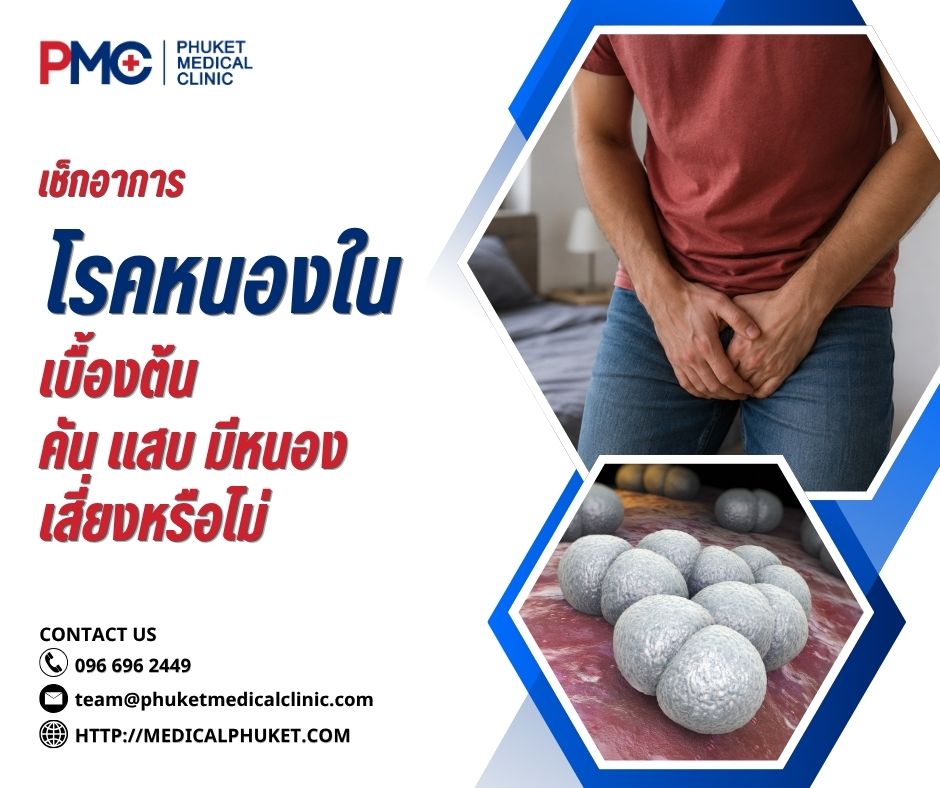 เช็กอาการโรคหนองในเบื้องต้น คัน แสบ มีหนอง เสี่ยงหรือไม่