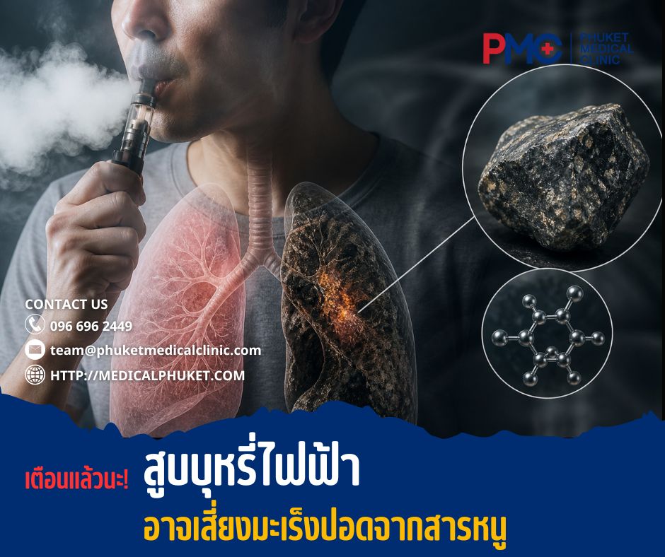 เตือนแล้วนะ! สูบบุหรี่ไฟฟ้าอาจเสี่ยงมะเร็งปอดจากสารหนู