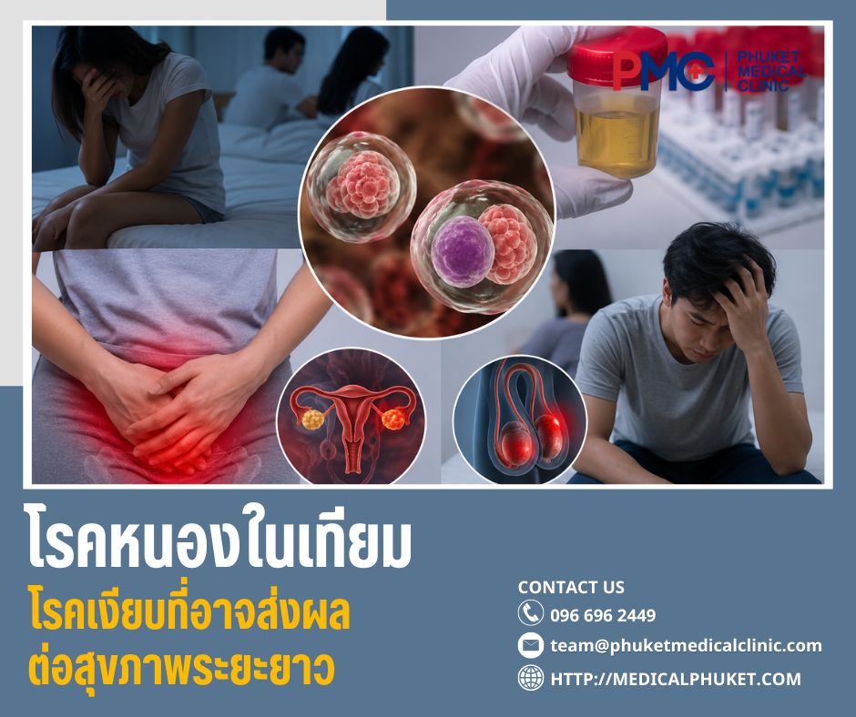 โรคหนองในเทียม โรคเงียบที่อาจส่งผลต่อสุขภาพระยะยาว