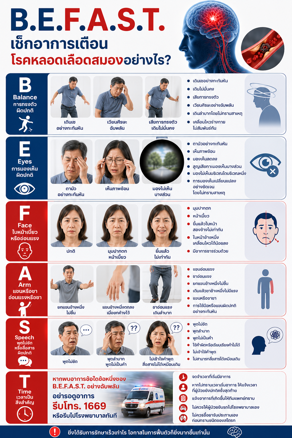 B.E.F.A.S.T. เช็กอาการเตือนโรคหลอดเลือดสมองอย่างไร?