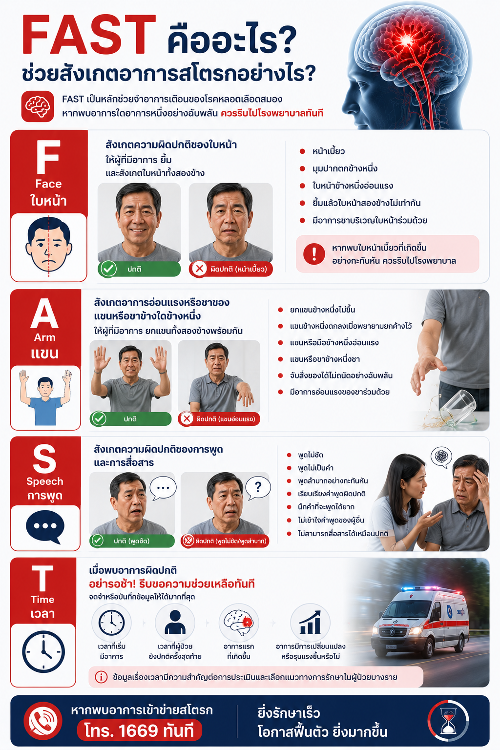 FAST คืออะไร? ช่วยสังเกตอาการสโตรกอย่างไร?