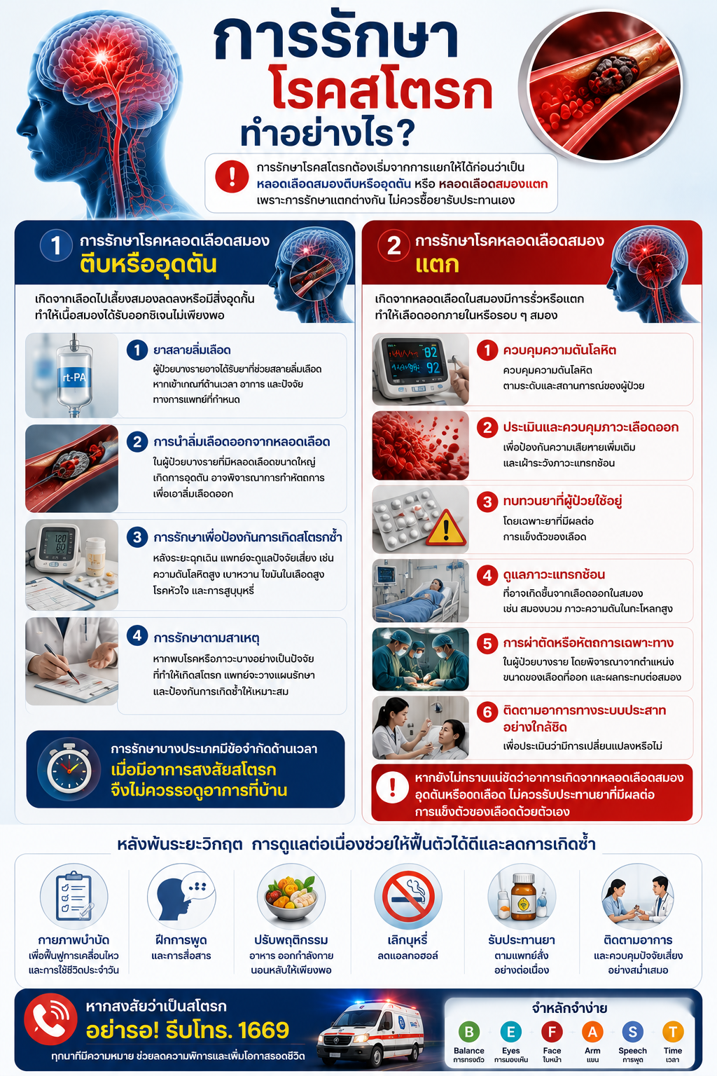 การรักษาโรคสโตรกทำอย่างไร?